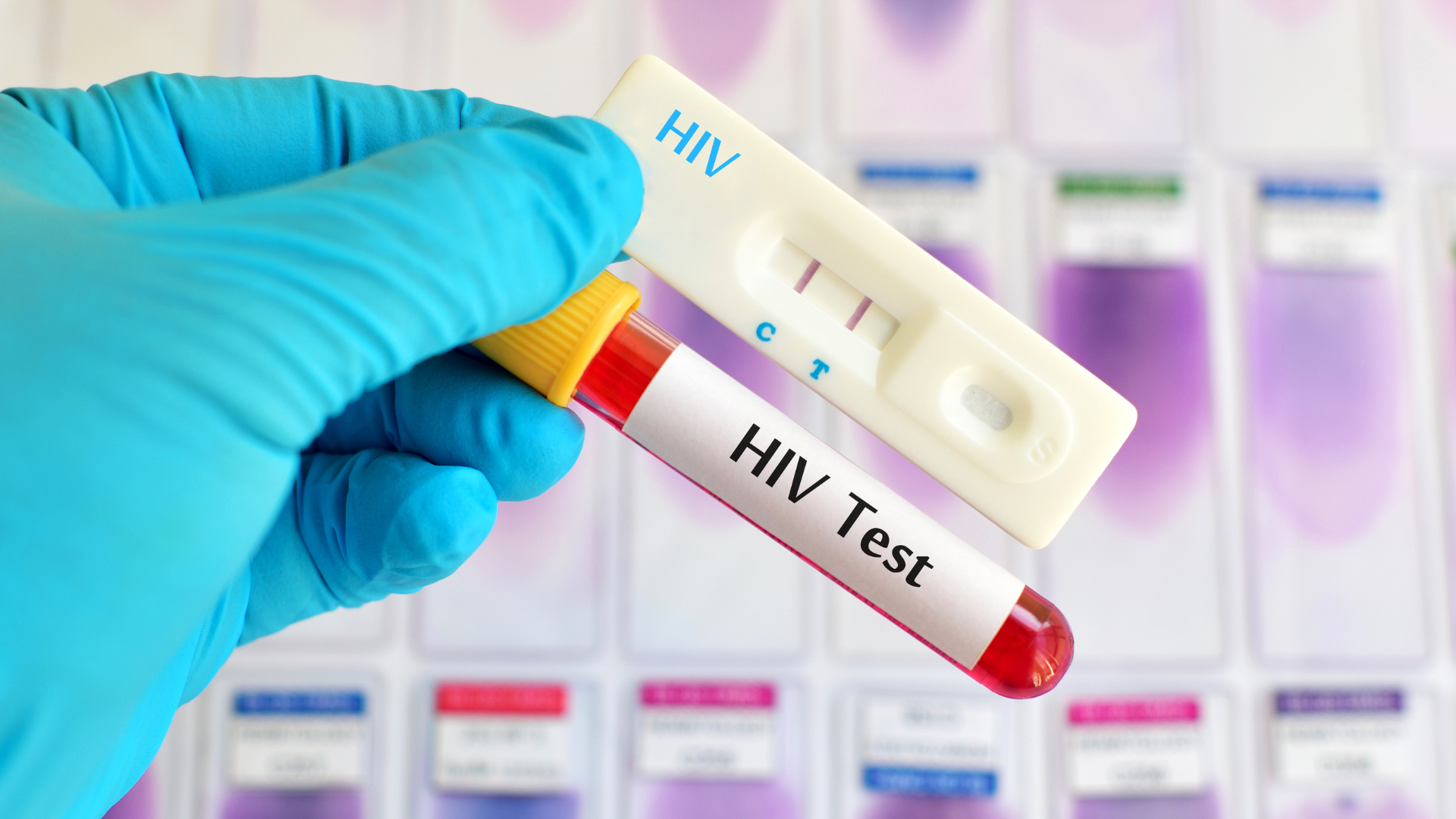 Ý nghĩa các chỉ số trên que test ma túy | Giải thích chi tiết và dễ hiểu